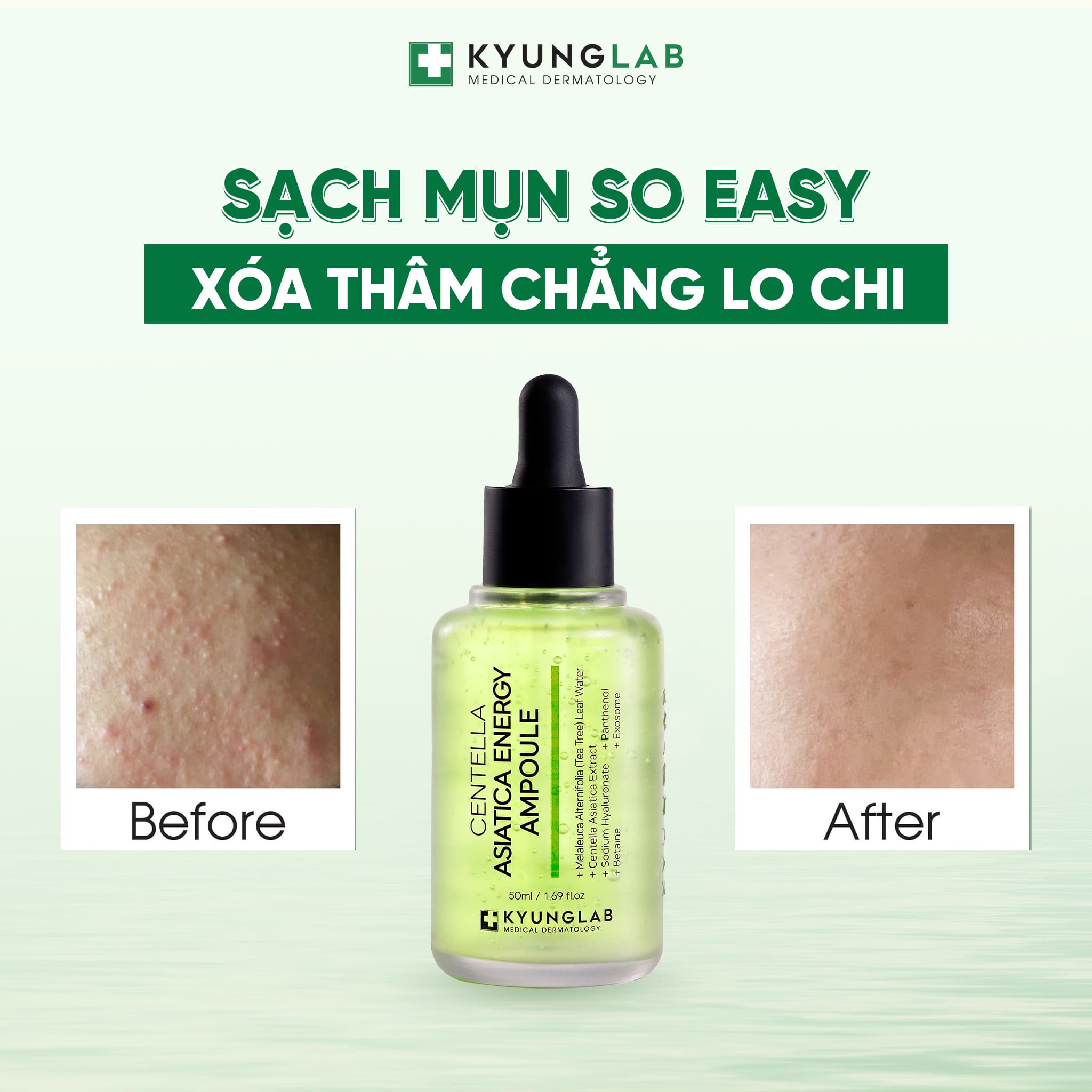 Serum Mụn KyungLab Centella Asiatica Energy Ampoule - Nhập Khẩu Chính Ngạch Có Tem Phụ Tiếng Việt Có VAT, Có Tem Chống Hàng Giả - Mẫu Mới 2024
